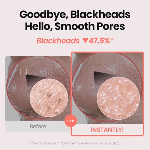 MAXCLINIC Rose Vitamin Oil-to-Foam Cleanser | Blackhead & Pore Care