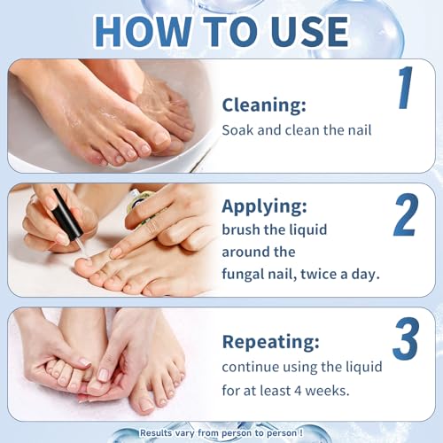 Maximum Strength Nail Fungi Treatment - Fast Acting Liquid Drops