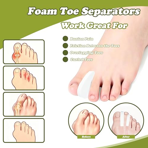 Xymoso Foam Toe Separators for Pain Relief - 40 Pack, 2 Sizes
