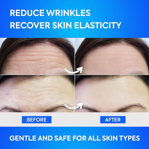 Forehead Wrinkle Patches with Collagen & Aloe - 12 Count