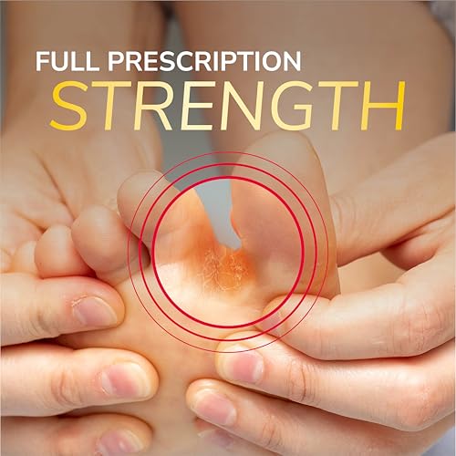 Dr. Scholl's Fungal-X Antifungal Cream for Athlete's Foot & Jock Itch - 1 oz