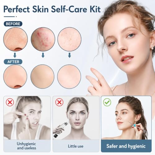 MENOLY 10-Piece Blackhead Remover Tool Kit with Anti-Slip Handle