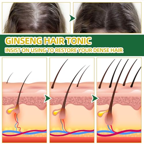 Hair Growth Spray with Biotin & Keratin - OUHOE (2 Pack)