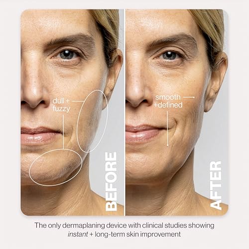 DERMAFLASH LUXE+ Sonic Dermaplaning Tool for Face