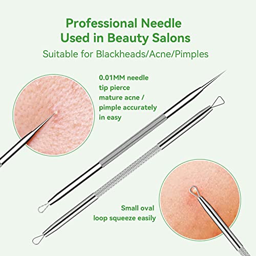 5-Piece Blackhead Remover Tool Kit - Pimple Popper Extractor Set
