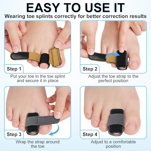 Hammer Toe Straightener with Aluminum Plate - Adjustable Toe Corrector