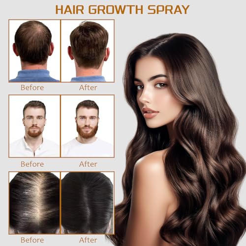 5% Minoxidil Spray with Biotin for Hair Regrowth - 100ml