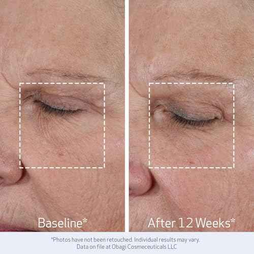 Obagi ELASTIderm Lift Up & Sculpt Facial Moisturizer ? Clinically Proven Anti-Aging Face Cream that Visibly Firms & Sculpts Facial Contours, & Reduces Fine Lines & Wrinkles with Peptides ? 1.7 oz