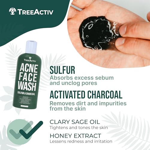 TreeActiv Charcoal Acne Exfoliating Face Wash | Hydrating Sulfur Cleanser for Pimple, Zit, Whitehead, & Blackhead | Facial Treatment for Hormonal & Cystic Acne | Teen & Adult Milia Remover | 425+ Uses