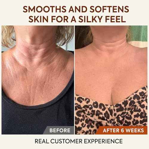 Whipped Tallow Honey Balm ? Natural & Organic Face Moisturizer for Crepey, Mature, Dry Skin ? Crepey Skin Cream with Raw Manuka Honey & Olive Oil ? 2.12 oz