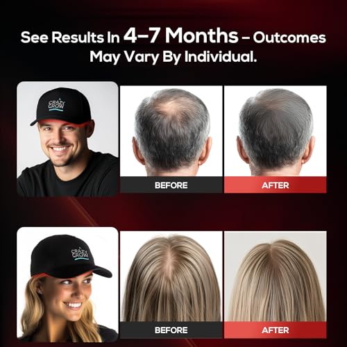 Laser Hair Growth Cap - LLLT Device for Men & Women