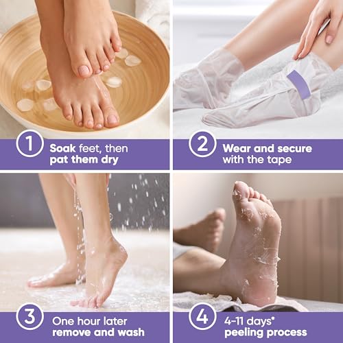 CÉLOR Foot Peeling Mask - Exfoliate Dry Cracked Feet (2 Pairs)