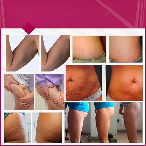 Anti Cellulite Cream ? Hot Body Firming Gel for Smoother Looking Skin, Improves Appearance of Uneven Texture & Elasticity, Warming Body Cream for Thighs & Stomach, 5.07 Oz