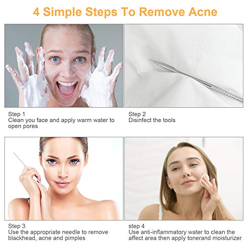 UUBAAR Blackhead Remover Kit, 9 Pimple Popper Tools with Tweezers