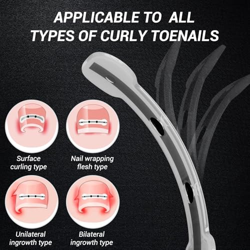 Ingrown Toenail Treatment Kit - Titanium Alloy Curved Nail Repair