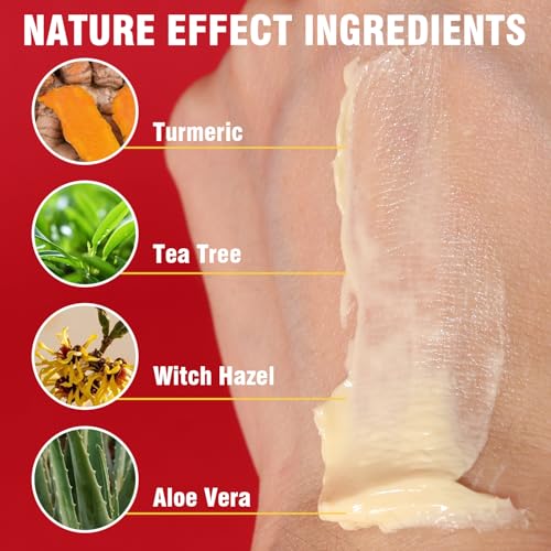Turmeric Pore Clay Mask - Deep Cleansing Acnes Skincare Facial Mask, Oil Control & Instant Glow for Oily & Dull Skin, Blackhead Gentle Exfoliation with Aloe & Vitamin E, 120g/4.23oz