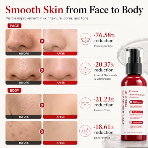 Exfoliating Serum with Hypochlorous Acid & Rice Extract – Gentle Face & Body Peel