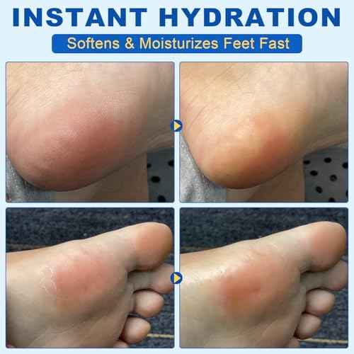 60% Urea Foot Cream, 1.41Fl Oz Foot Cream Maximum Strength Moisturizer for Dry Cracked Heels, Urea Foot Lotion Nourish Cracking Rough Dry Hands/Feet