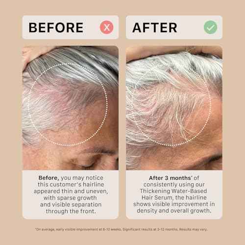 ACTIIV Thickening Hair Serum - Water Based | Supports the Appearance of Thicker, Fuller-Looking Hair, Lightweight Water-Based Formula, Non-Greasy, All Hair Types, 1.8 oz