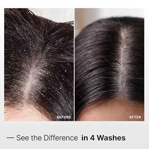 My Way Hair DNA Detox Shampoo ? Deep Clarifying Formula for Product Buildup, Scalp Health Balance, and Damage Repair ? Paraben, Phthalate, Sulfate, and Cruelty-Free Hair Care (8 oz)