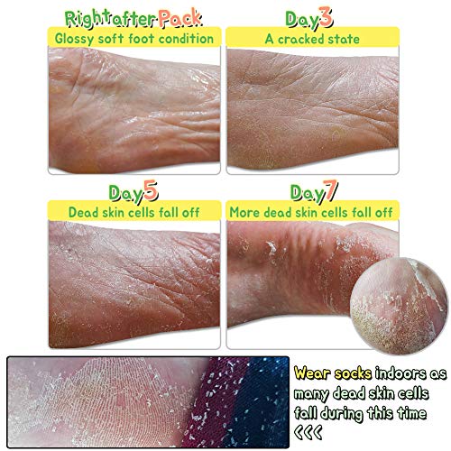 Elizavecca Foot Peel Mask - Exfoliating Foot Pack for Soft Skin