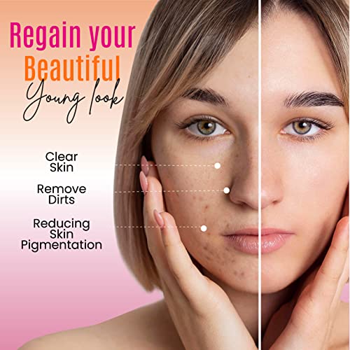 Organic Kojic acid & Vitamin C Soap Bar | Arbutin, Glutathione | Advanced Glowing formula, Replenish, & Radiant Skin | Pure Natural Pigmentation For Face & Body - 5 OZ Each (Pack 1)