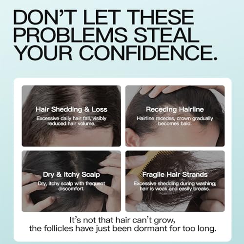 5% Minoxidil Hair Growth Cream for Men & Women