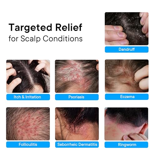 ProBliva Psoriasis Scalp Spray – 3% Salicylic Acid Treatment