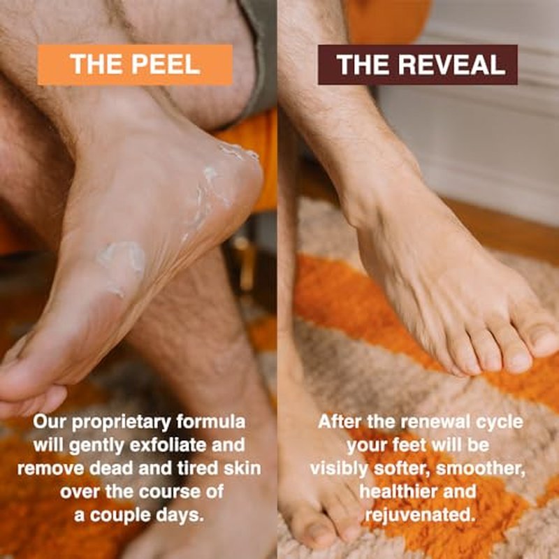 FEETS Foot Peel Mask - Eucalyptus & Lavender, 2-Pack for Soft Feet