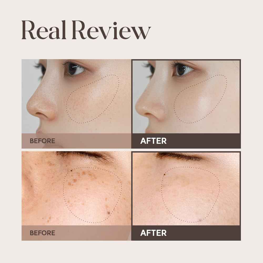 Lulubeu Mela Clinic Ampoule with NK Cell Technology, Skin Tone Care Serum with Tranexamic Acid, Glutathione & Bisabolol, 0.5 fl oz