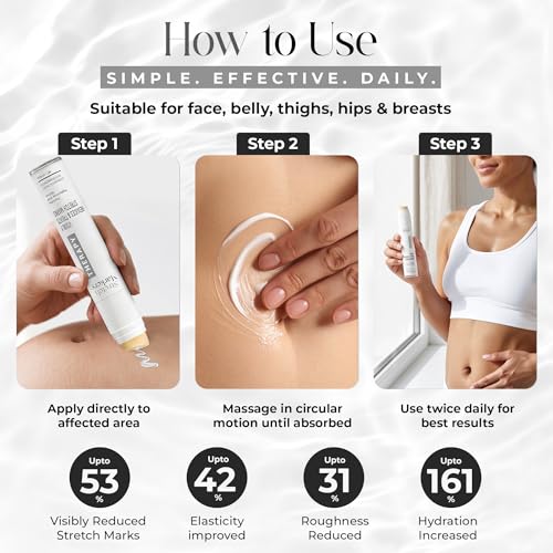 StretchMarkers Therapy Stretch Mark Cream – Retinol & Hyaluronic Acid