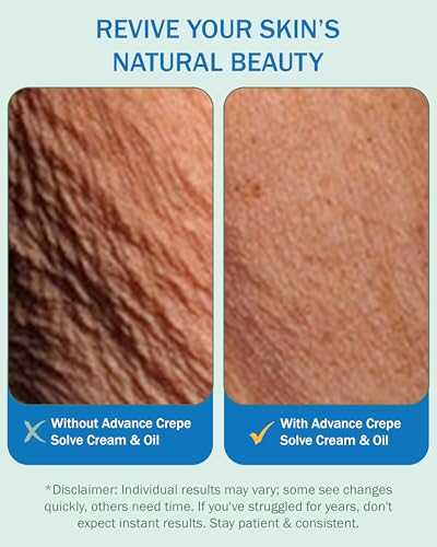 e70 Crepe Skin Erase Cream Set – 2-Pack Firming Body Cream