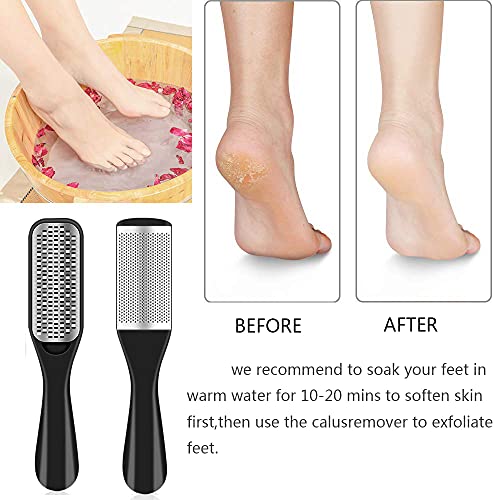36-in-1 Professional Pedicure Kit - Stainless Steel Foot File & Case