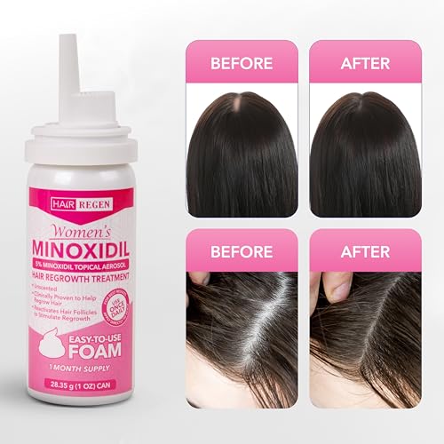 Hair Regen 5% Minoxidil Foam for Women - 6 Month Supply