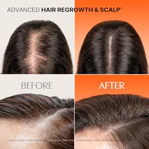 lilyeve GROWTURN Exosome Hair Growth Ampoule 3000