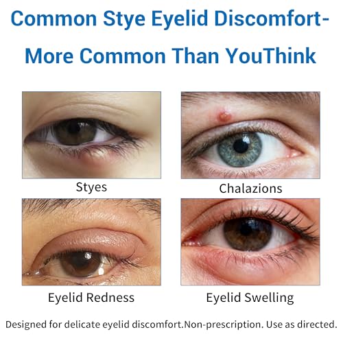Stye Eye Treatment Relief - 30ml Fast-Absorbing Eyelid Care