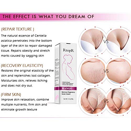 Mango Stretch Mark & Scar Removal Cream 40g