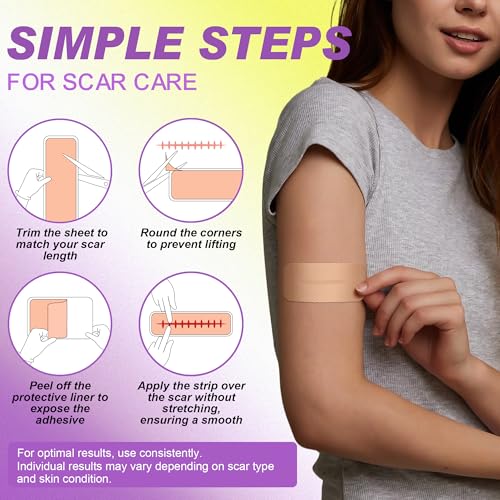 FRESINIDER Silicone Scar Sheets Roll - 1.6" X 120" (3 Meters) Silicone Scar Tape for Surgical C-Section Tummy Tuck, Keloid Burn Acne - Extra Long & Reusable Professional Scar Removal Strips