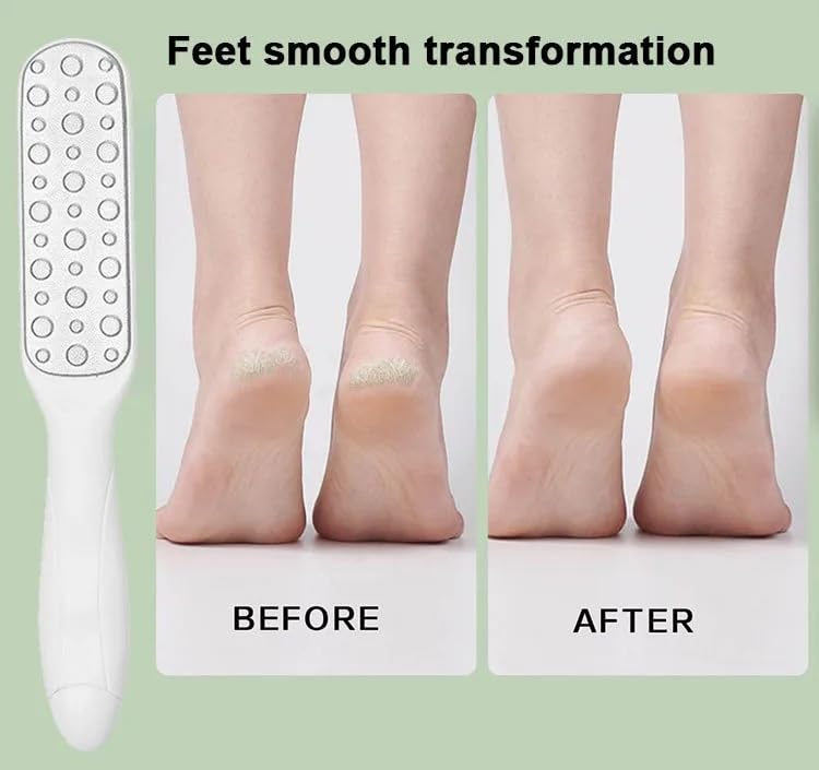 Foot File Dead Skin Remover | Hygenic Stainless Steel | Pedicure Professional Double Sided Rasp Callus Dead Heel Skin Remover for Wet and Dry Feet