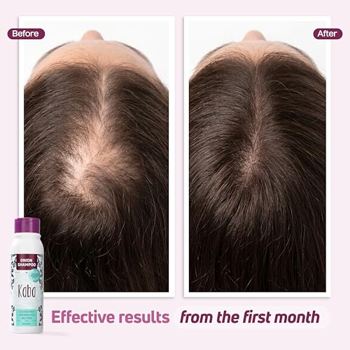 Kaba Onion Shampoo for Thicker Hair - 500 ML, Sulfate-Free