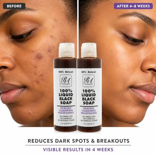 African Liquid Black Soap - 100% Natural for Face & Body - 8 oz