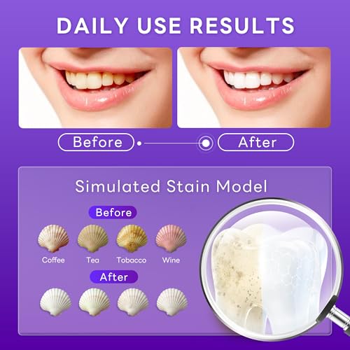 SAKYPRORAL Purple Whitening Toothpaste 3.88oz Pack of 3 - Dual Enzyme Stain Removal