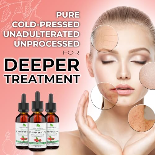 Rosehip Oil - Pure, Virgin, Cold Pressed - From Whole Berries (Pulp & Seeds), Natural Deep Orange Hue for Intensive Skin Repair - Undiluted Organic Rosehip Seed Oil, 2 oz