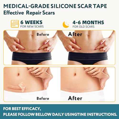 Silicone Scar Sheets, Silicone Scar Tape for Surgical Scars - 60" x 1.6" Roll - 1.5M, Medical Grade Reusable Effective Scar Removal for Keloid, C-Section, Tummy Tuck, and Acne