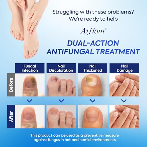 Toenail Fungus Treatment Kit with 25% Undecylenic Acid & Patches
