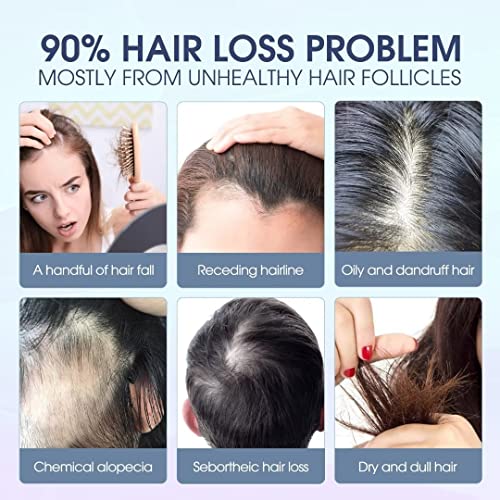 Laser Hair Growth Cap 180 Lasers, Hair Loss Treatments For Men and Women, Hair Regrowth Helmet For Thinning Hair, Low Level Laser Therapy Hair Growth Products