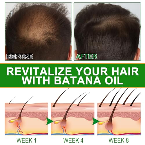Batana Oil for Hair Growth with Scalp Massager - 100% Pure & Natural Batana Oil from Honduras, Eliminate Hair Split Ends,Enhances Hair & Skin Radiance Nourishment, All Hair Types 2.02 fl oz