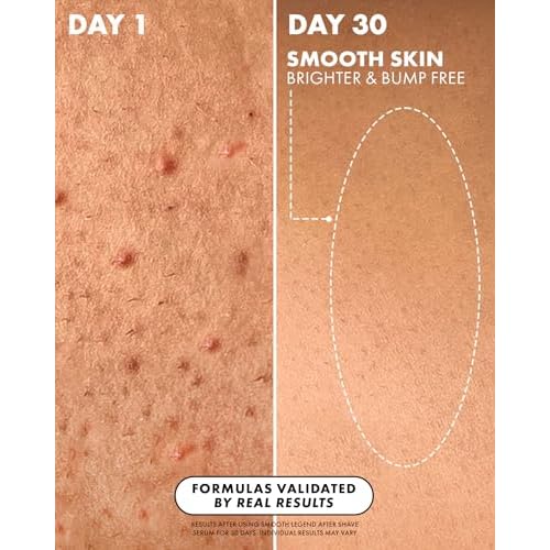 Truly Luxury After Shave Serum | Soothing & Hydrating Post Shave Treatment to Prevent Ingrown Hair For Smooth, Irritation-Free Skin