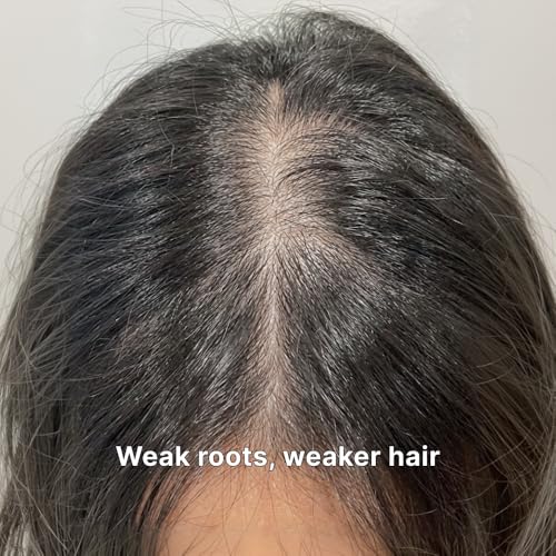 Black Grain Shampoo for Thinning Hair – Strengthening Formula, 16.9 fl oz