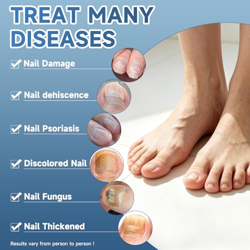 Maximum Strength Nail Fungi Treatment - Fast Acting Liquid Drops